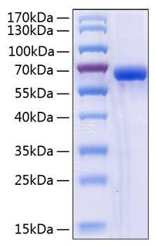 Recombinant Human NKG2D ligand 2/ULBP2 Protein (RPCB0383)