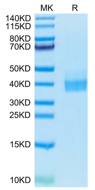 Biotinylated Recombinant Human B7-H1/PD-L1/CD274 Protein (RPCB0405)
