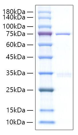 Recombinant Human Cyr61/CCN1 Protein (RPCB0428)