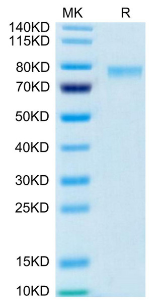 Biotinylated Recombinant Human TNFSF9/4-1BB Ligand Trimer Protein (Primary Amine Labeling) (RPCB0452)