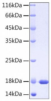 Recombinant Human IL-37/IL-1F7 Protein (RPCB0484)
