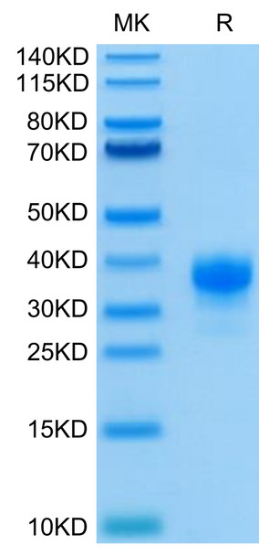 Recombinant Human Fc gamma RIIA/FCGR2A/CD32a (H167R) Protein (RPCB0495)