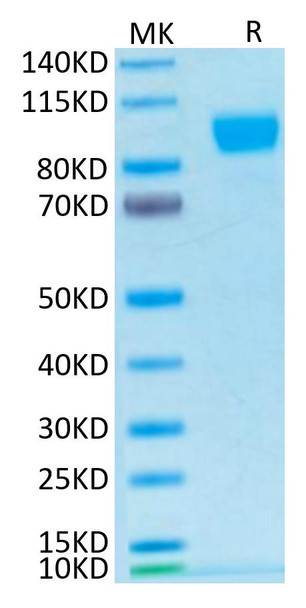Biotinylated Recombinant Human ErbB-2/HER2/CD340 Protein (RPCB0499)