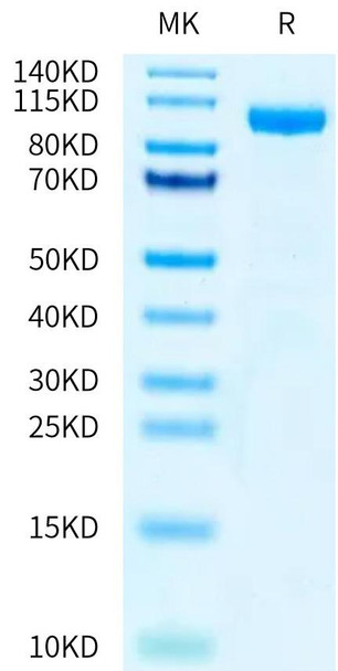 Recombinant Human IL-12 R beta 1/CD212 Protein (RPCB0518)