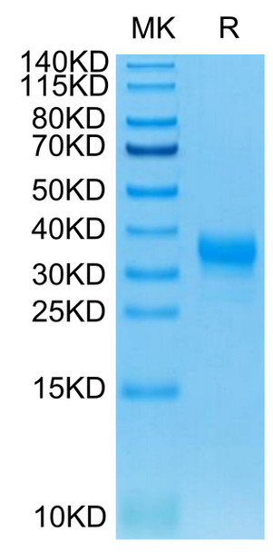 Recombinant Human Fc gamma RIIA/FCGR2A/CD32a Protein (RPCB0542)