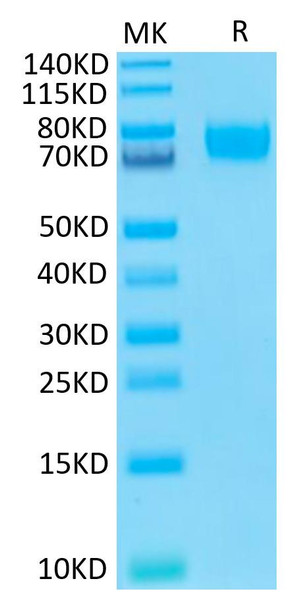 Biotinylated Recombinant Human B7-H3 (4Ig)/B7-H3b/CD276 Protein (RPCB0572)