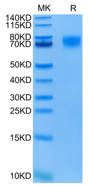 FITC-Labeled Recombinant Human ERBB1/HER1/EGFR (25-378) Protein (RPCB0578)