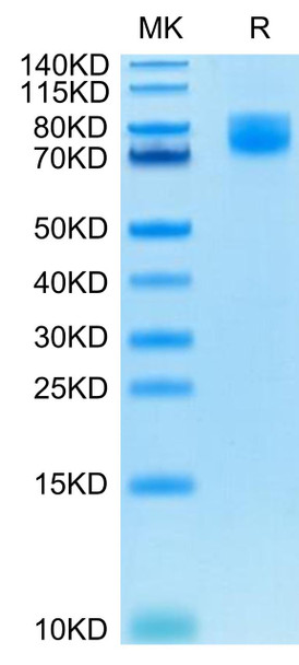 Recombinant Human B7-2/CD86 Protein (RPCB0588)
