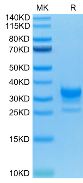 Recombinant Human Fc gamma RIIB/FCGR2B/CD32b Protein (RPCB0627)
