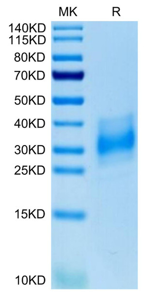 Recombinant Human Basigin EMMPRIN/CD147 Protein (RPCB0656)