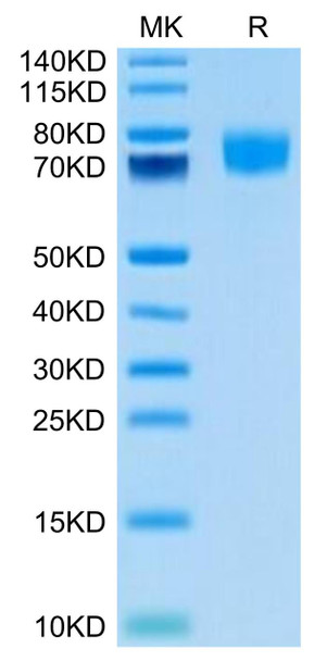 Biotinylated Recombinant Human ALCAM/CD166 Protein (Primary Amine Labeling) (RPCB0668)