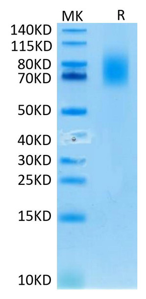 Recombinant Human TNFRSF8/CD30 Protein (RPCB0672)