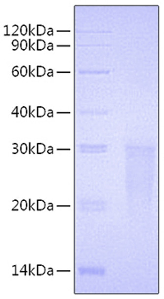 Recombinant Human TMIGD2/CD28H Protein (RPCB0716)
