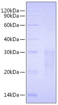 Recombinant Human TMIGD2/CD28H Protein (RPCB0716)