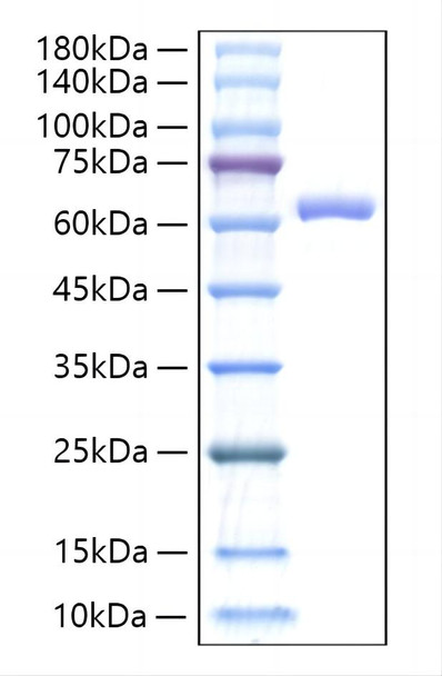 Recombinant Mouse IL-27/IL-27A&IL-27B Protein (RPCB0721)