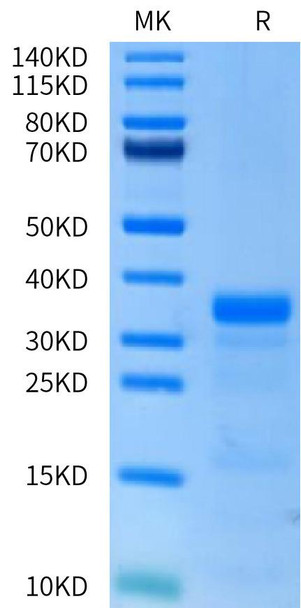 Recombinant Human uPA/PLAU Protein (RPCB0732)