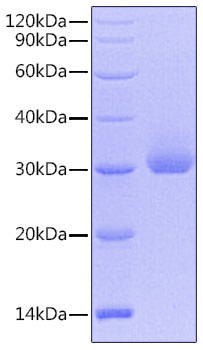 Recombinant Human Kallikrein-4/KLK4 Protein (RPCB0734)