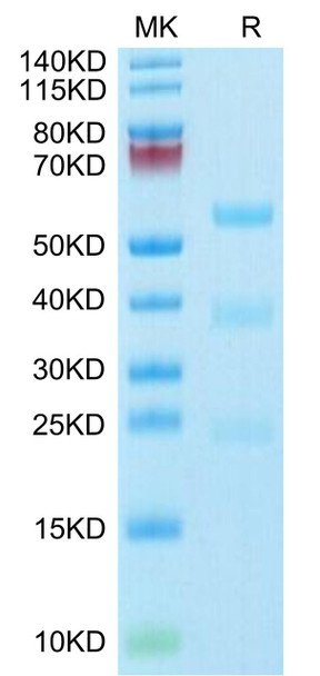 Biotinylated Recombinant Human uPA/PLAU Protein (RPCB0739)