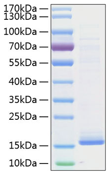 Recombinant Human Cystatin-D/CST5 Protein (RPCB0767)