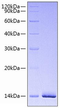 Recombinant Human Estrogen receptor/ESR1 Protein (RPCB0786)