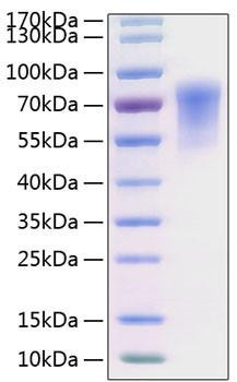 Recombinant Human CADM1/IGSF4A Protein (RPCB0800)