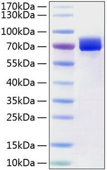 Recombinant Human Mesothelin/MSLN Protein (RPCB0826)