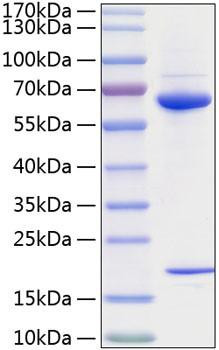 Recombinant Human PCSK9 Protein (RPCB0829)
