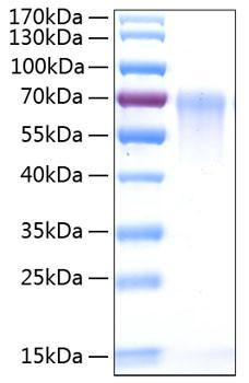 Recombinant Human DAF/CD55 Protein (RPCB0840)