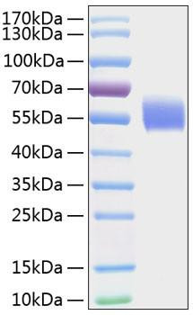 Recombinant Human IL-1R1/CD121a Protein (RPCB0850)