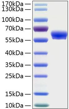 Recombinant Human Layilin/LAYN Protein (RPCB0885)
