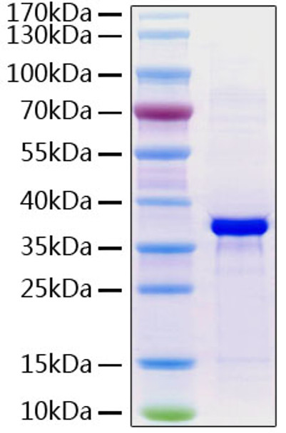 Recombinant Human Fibrinogen like 1/FGL1 Protein (RPCB0900)