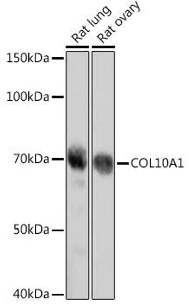Anti-COL10A1 Antibody (CAB18604)