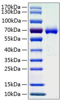 Recombinant Human Ephrin-A3/EFNA3 Protein (RPCB0922)