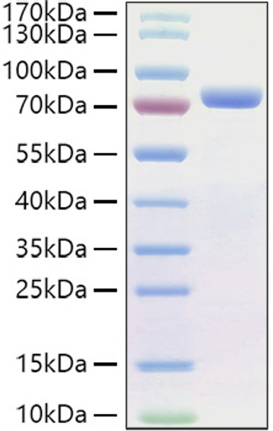 Recombinant Human E-Cadherin/CDH1/CD324 Protein (RPCB0944)