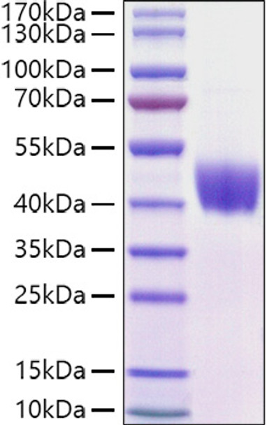 Recombinant Mouse Mesothelin/MSLN Protein (RPCB0953)