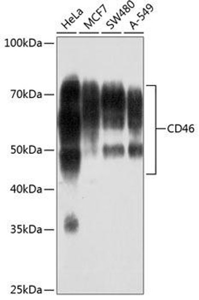 Anti-CD46 Antibody (CAB19022)