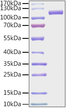 Recombinant Mouse CDCP1/gp140/CD318 Protein (RPCB0962)