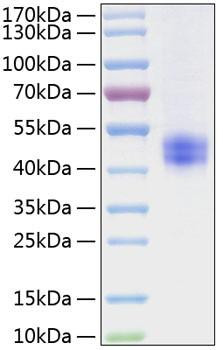 Recombinant Mouse Follistatin/FST Protein (RPCB0966)