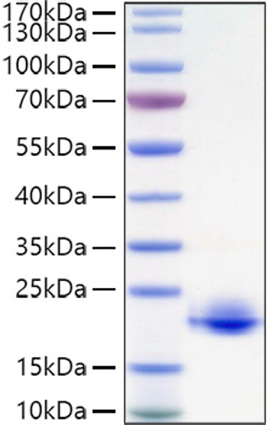 Recombinant Human Myelin oligodendrocyte glycoprotein/MOFG Protein (RPCB0976)