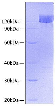Recombinant Mouse PDGFR-alpha/CD140a Protein (RPCB0985)