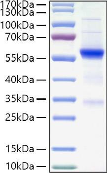 Recombinant Human TET2 Protein (RPCB1001)