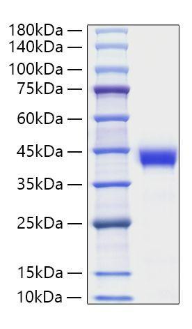 Recombinant Human Zinc-alpha-2-glycoprotein/AZGP1 Protein (RPCB1005)