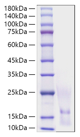 Recombinant Human CCL1/I-309 Protein (RPCB1021)
