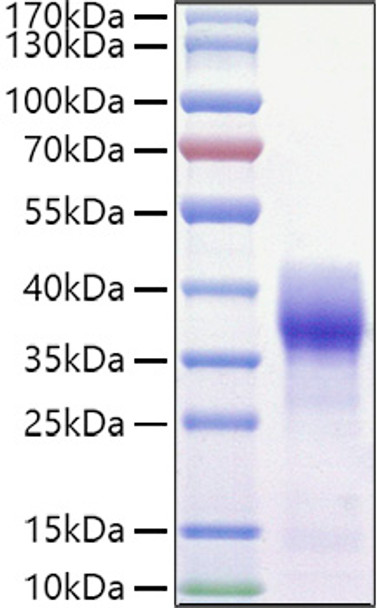 Recombinant Mouse Basigin/EMMPRIN/CD147 Protein (RPCB1041)