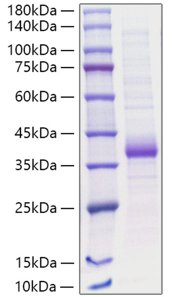 Recombinant Human Carbonic anhydrase 5A/CA5A Protein (RPCB1091)
