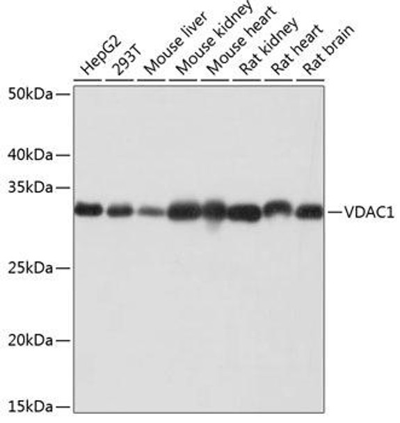 Anti-VDAC1 Antibody (CAB19707)