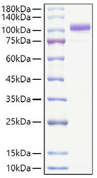 Recombinant Human Lysyl hydroxylase 2/PLOD2 Protein (RPCB1106)