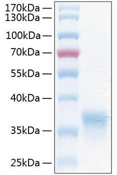 Recombinant Human HCVADR/CXADR Protein (RPCB1117)