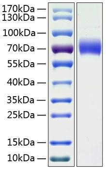 Recombinant Human Kininogen-1/KNG1 Protein (RPCB1125)