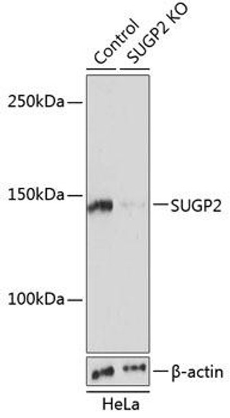 Anti-SUGP2 Antibody (CAB19888)[KO Validated]